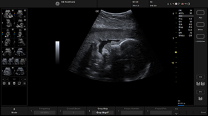 active-4c-ob-fetal-profile_1.jpg