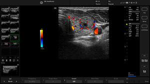 active-9l-thyroid-color_1.jpg