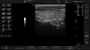 active-l612-thyroid_1.jpg