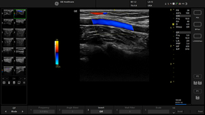 active-l62-uea-color_1.jpg