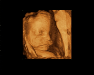 balance-ob-3d-fetal-face_1.jpg