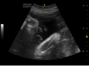 fetal-nose.png