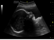 fetal-profile.png