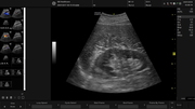 renal.jpg