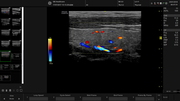 thyroid-2-color.jpg