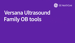 Overview of OB tools on the Versana systems