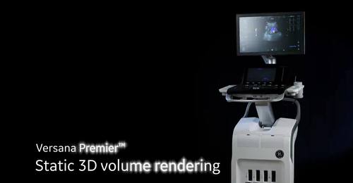 Versana Premier: Static 3D volume rendering