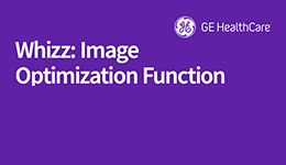 Whizz - image optimization function on Versana