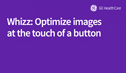 Whizz function & how to optimize 