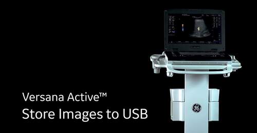 Versana Active: Store images to USB