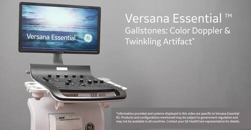 Gallstones: Color Doppler & Twinkling Artifact