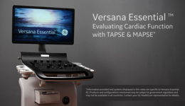 Evaluating Cardiac Function with TAPSE & MAPSE